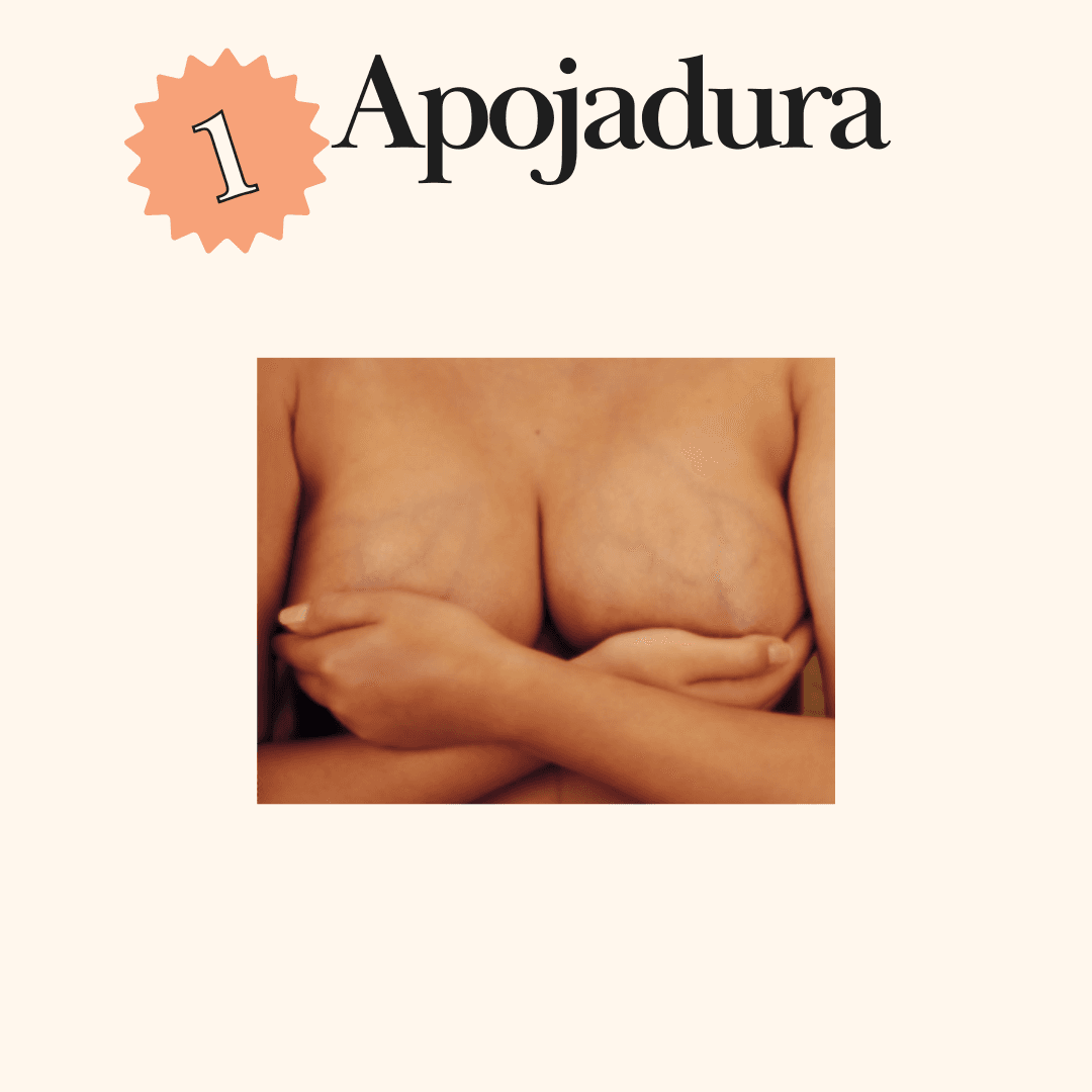 Apojadura